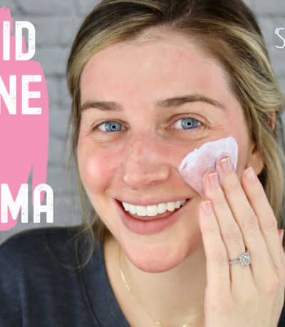 get rid of acne and hyperpigmentation